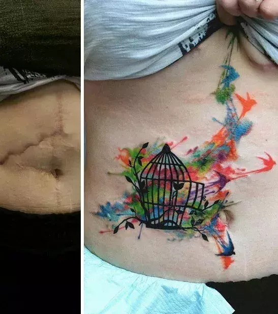 Bright watercolors: Colour splashes also help minimise the appearence of odd-shaped scars