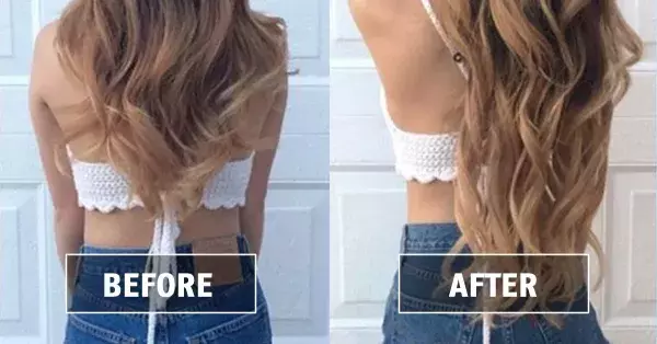 Hair
