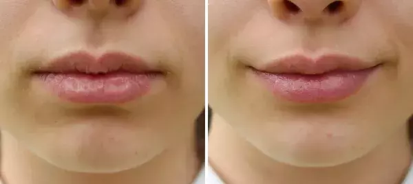 Lips