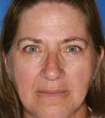 Her twin sister is also a smoker, but she smoked 17 years less than her sister