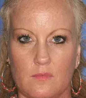 Her twin sister is a big smoker 