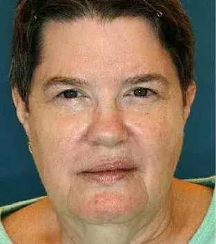 This woman has never smoked in her life    