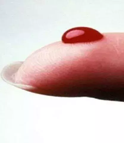 You have a group O blood type - Our dear mosquitoes love this blood type more than others.